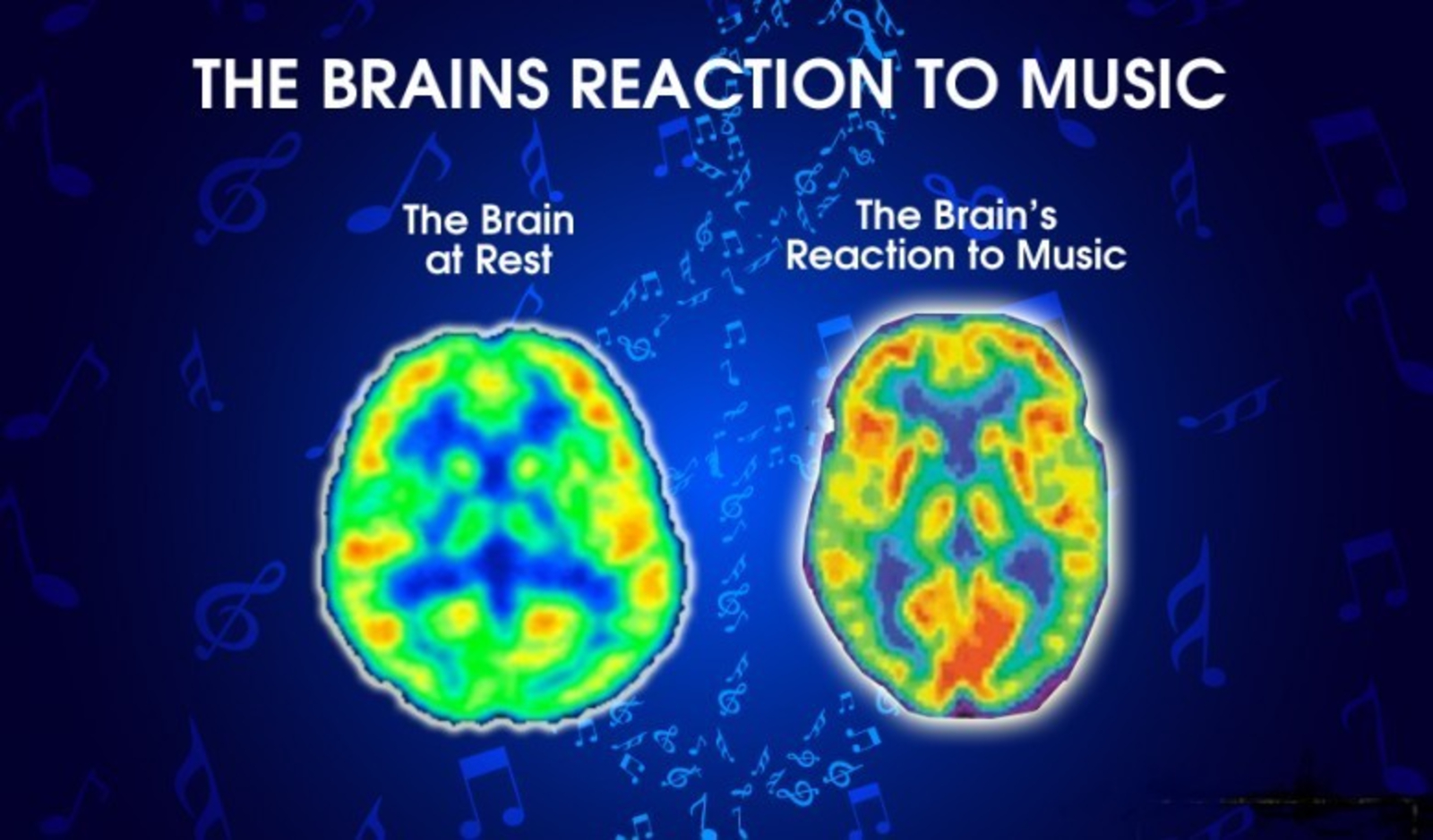 What Happens in the Brain When People Make Music Together